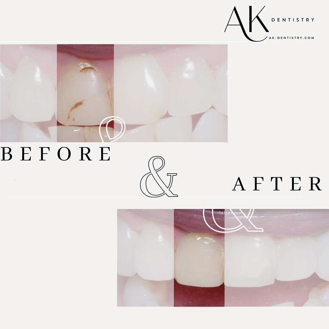 Before and After Image