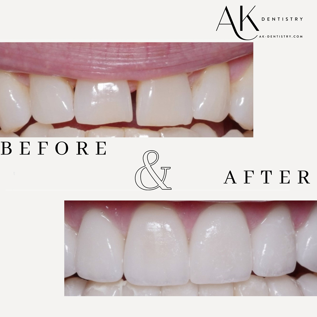 Before and After Image