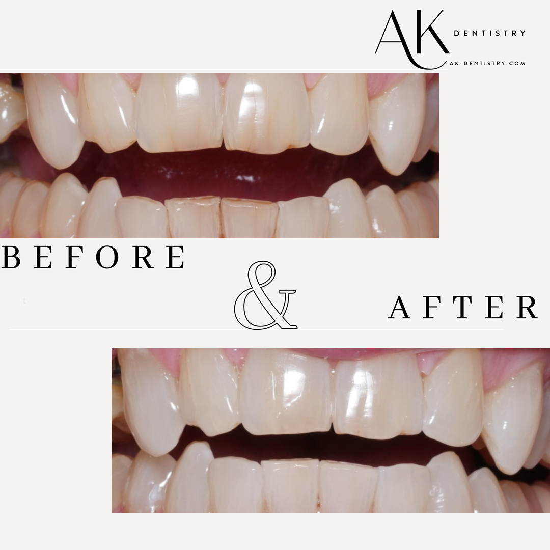 Before and After Image