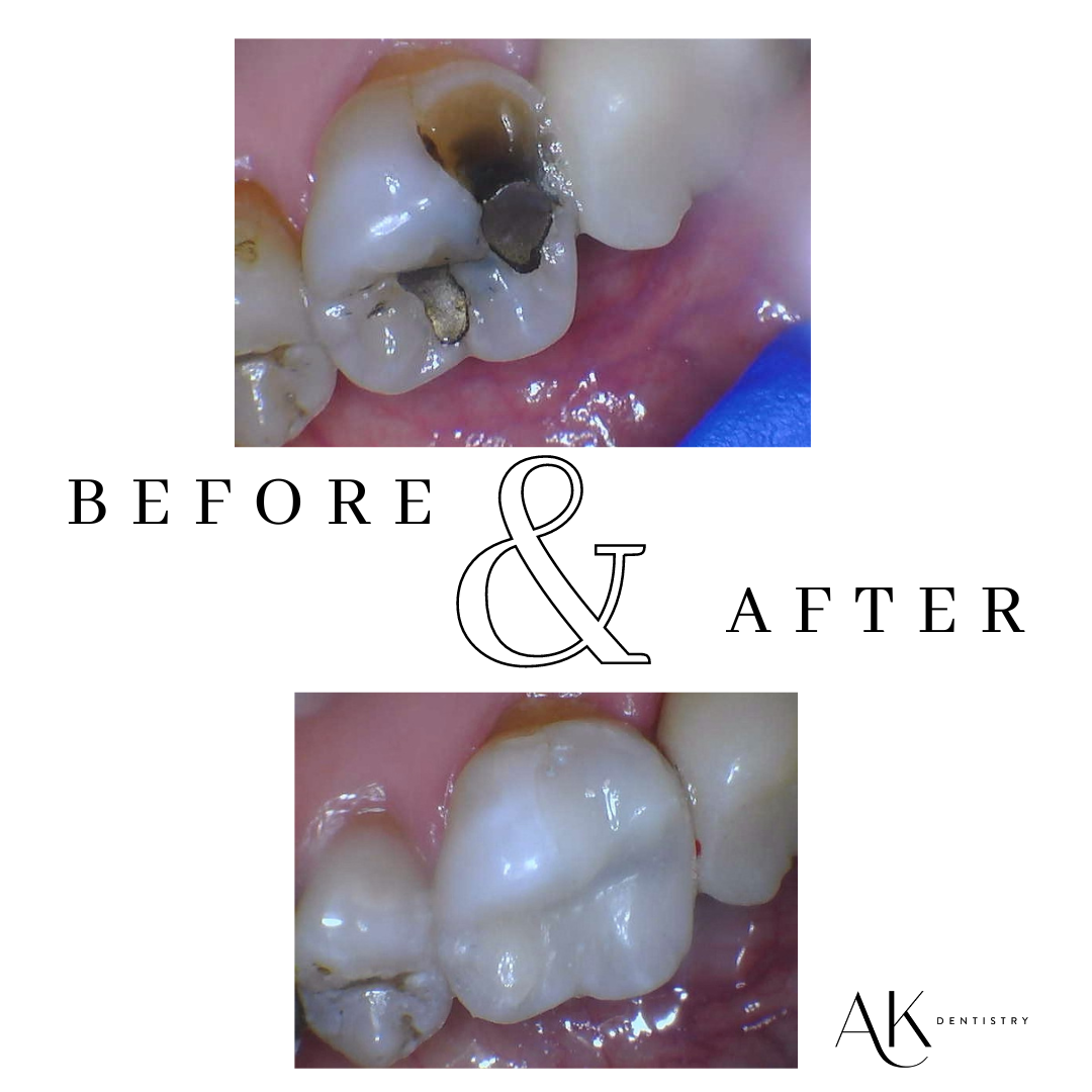 Before and After Image