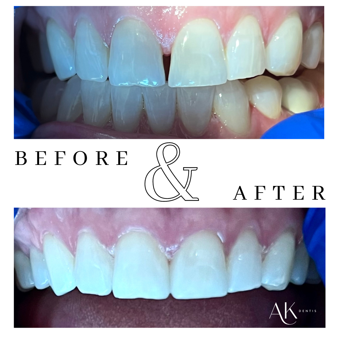 Before and After Image