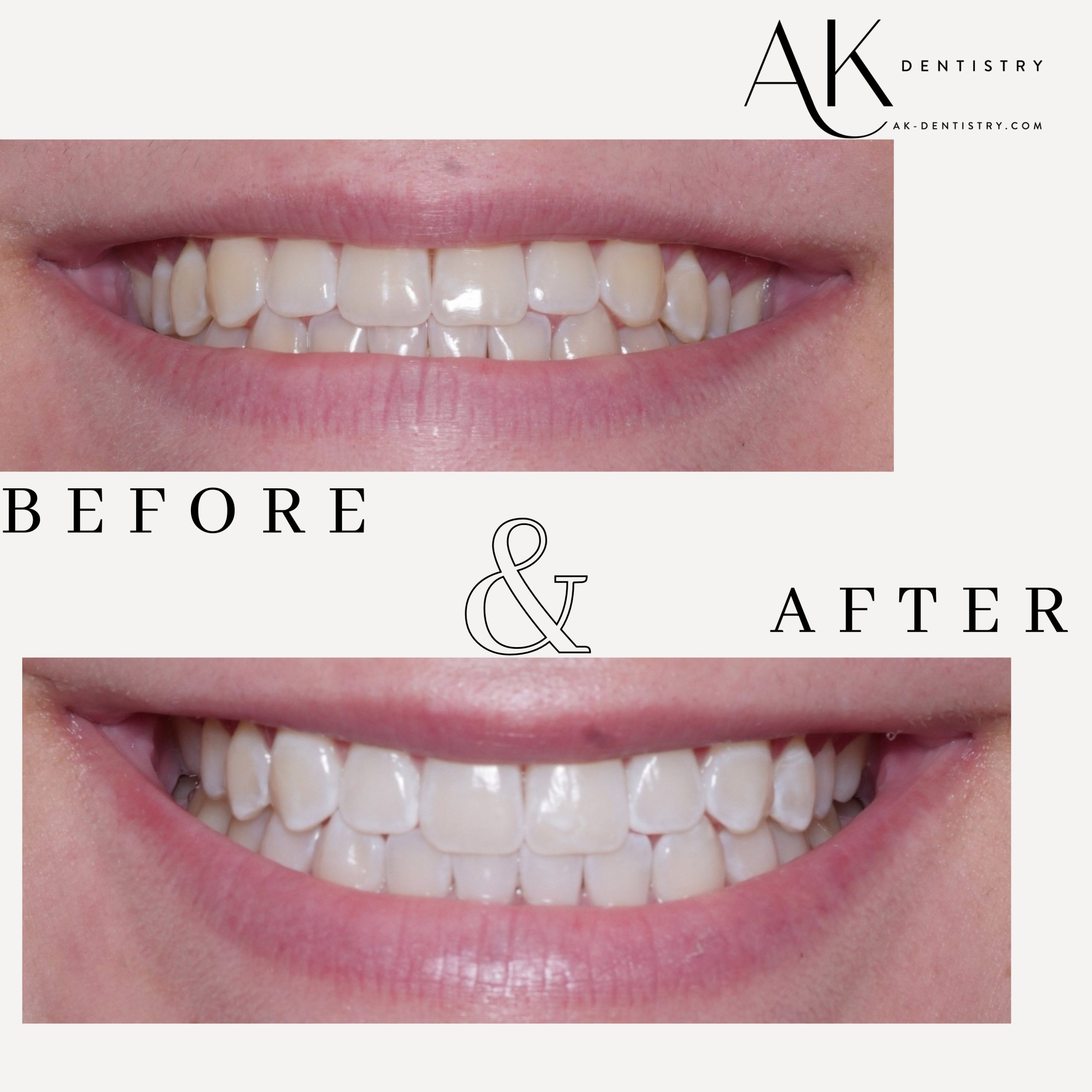 Before and After Image